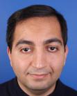 After Hair Transplant &nbsp;Front